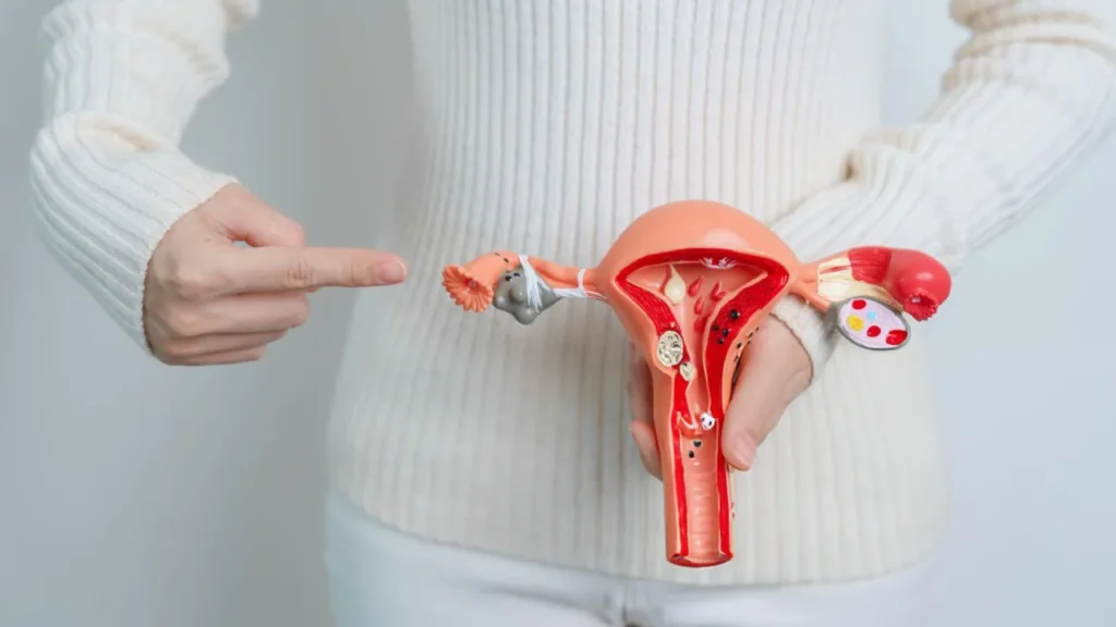 functional medicine for PCOS